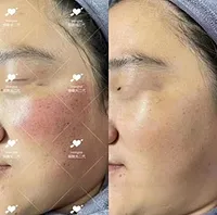 1109 卡娜美容 - 細胞光嫩膚 60分鐘
